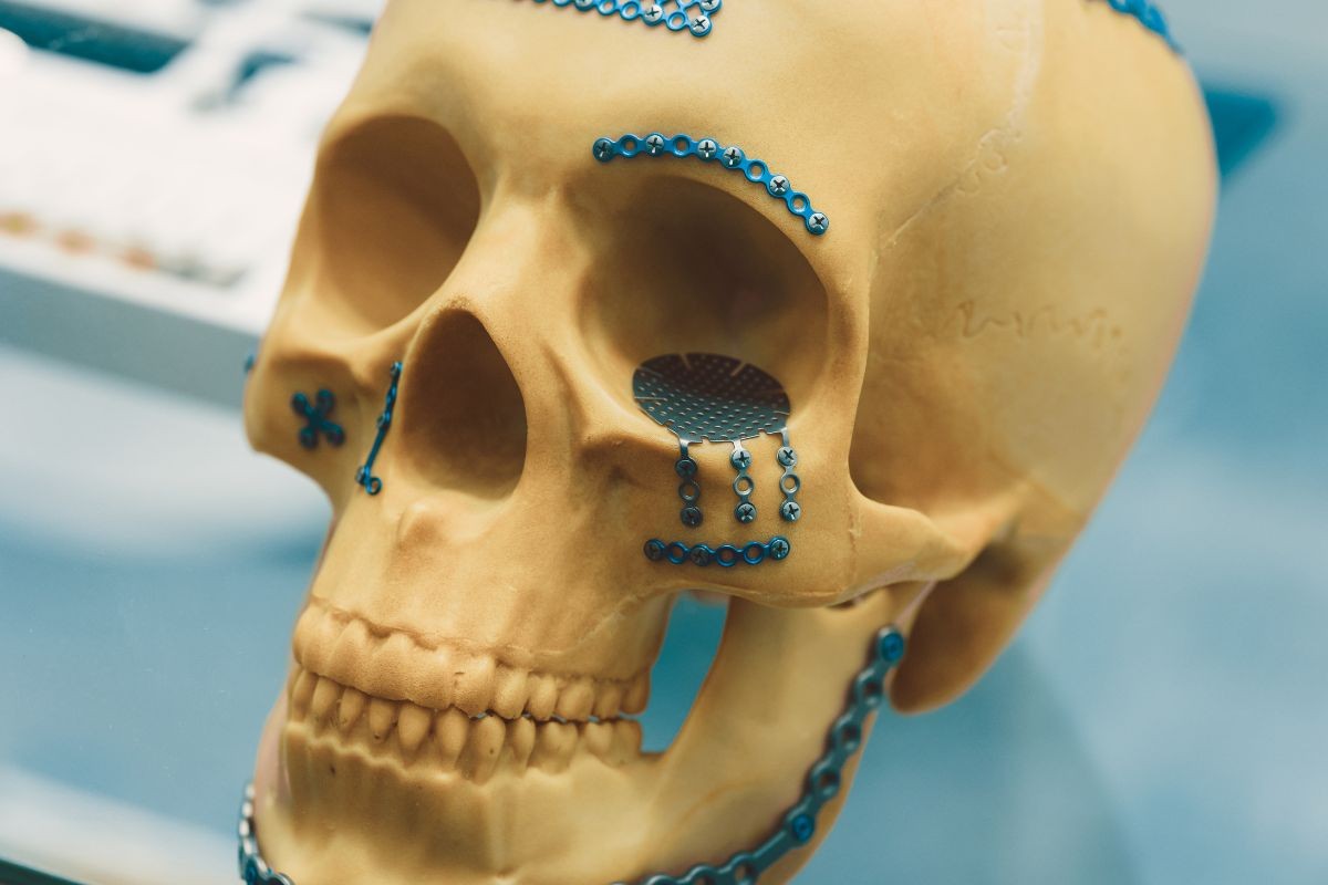 Cirurgia e Traumatologia Bucomaxilofacial