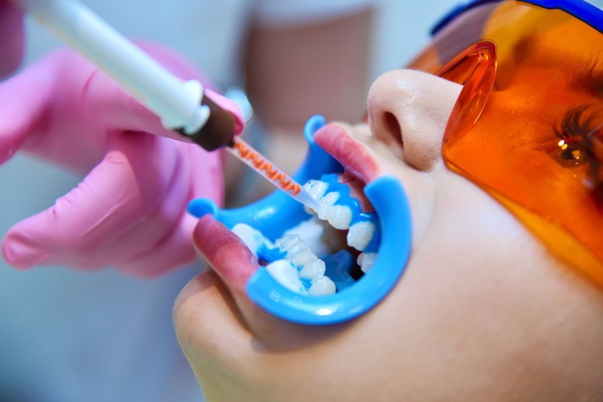 Clareamento Dental