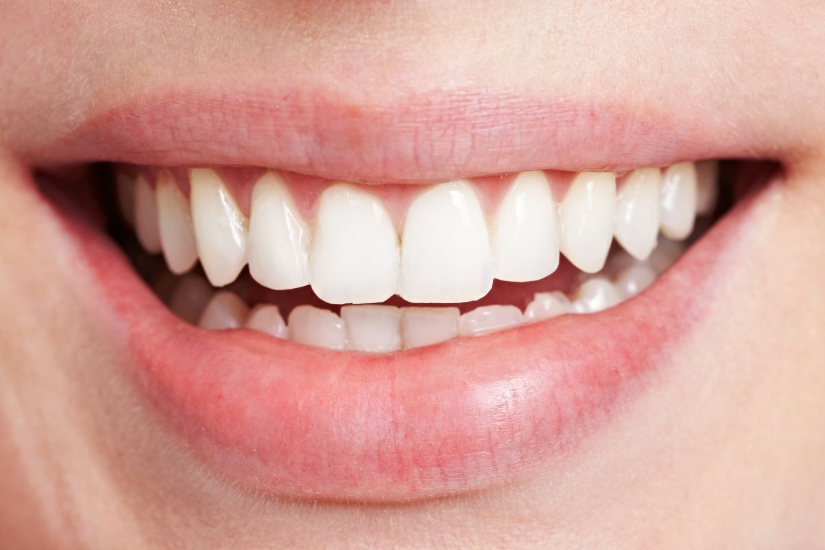 Tratamento para Desgaste dos Dentes