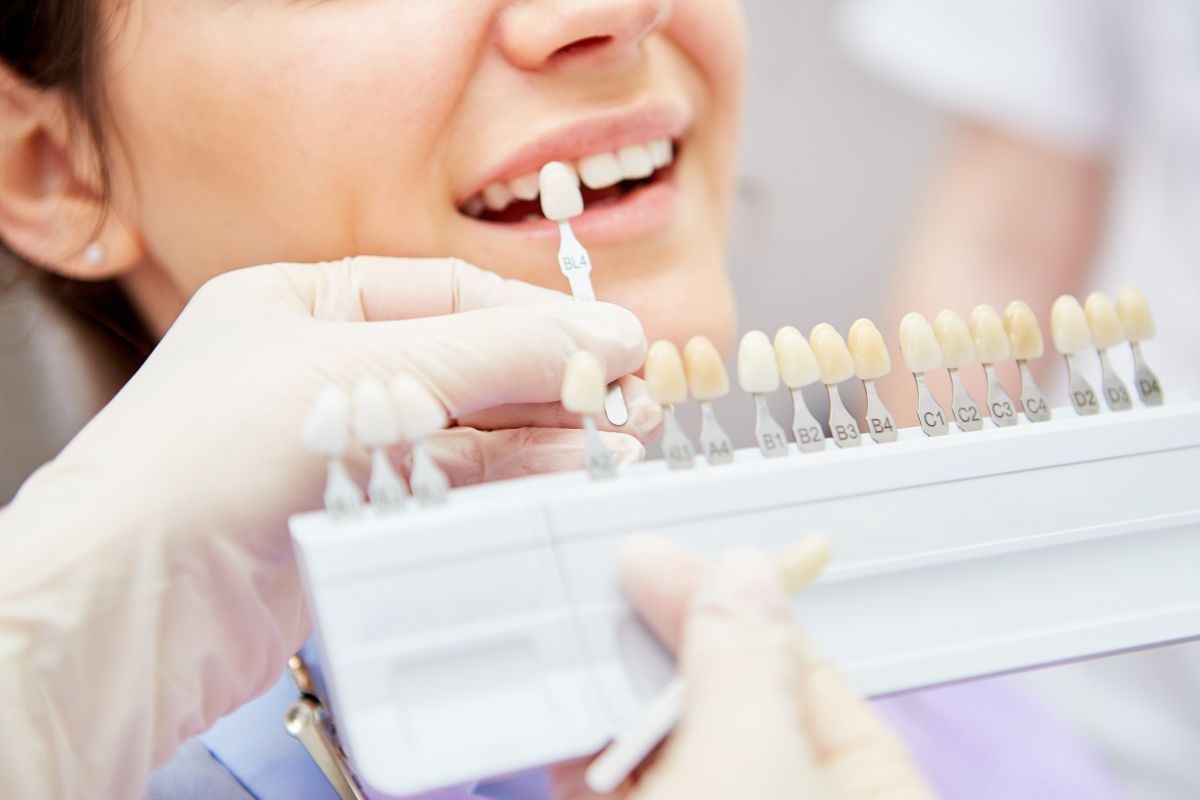 Tratamento para Alteração de Cor do Dente